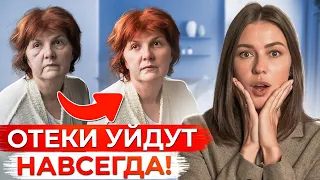 Как питание ИЗБАВИТ вас от отеков РАЗ И НАВСЕГДА! / Основные причины отеков