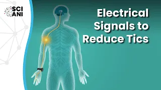 Can using electrical signals reduce the frequency of tics?