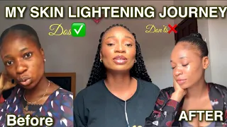 MY SKIN LIGHTENING JOURNEY. MISTAKES I MADE. How I transformed and got my light skin tone.