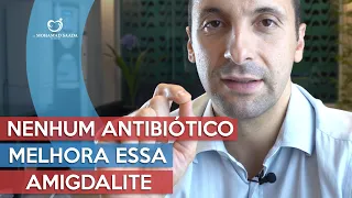 Nenhum Antibiótico Melhora Essa Amigdalite