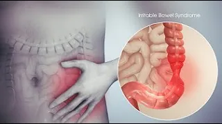 ❌ PARE de comer isso se você tem SÍNDROME DO INTESTINO IRRITÁVEL! - 2021/09/15 - Giovana Guido