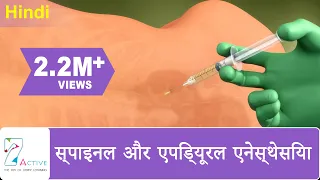 स्पाइनल और एपिड्यूरल एनेस्थेसिया | Spinal & Epidural Anesthesia | Hindi