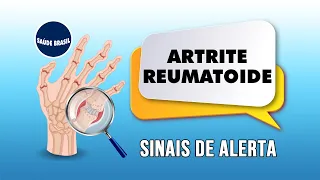 SINAIS DE ALERTA | ARTRITE REUMATOIDE