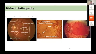 GPSN Y4C Revision Lecture 2021 - Ophthalmology