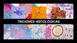 PRINCIPALES TINCIONES HISTOLÓGICAS