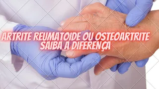 Artrite Reumatoide ou Osteoartrite SAIBA A DIFERENÇA