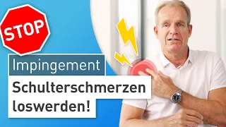 Impingement-Syndrom Schulter – Arthroskopische OP: Schluss mit Schulterschmerzen!