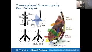 The Interventional Echocardiographer: Structural Imaging & Application in Mitral Valve TEER