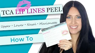 TCA Lip Peel | Demonstration + After Care | Smokers lines | Marionette | Nasal labial