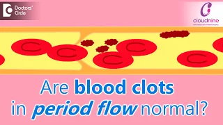 Why does menstrual bleeding have blood clots? Is it normal?-Dr.Shalini Varma of Cloudnine Hospitals