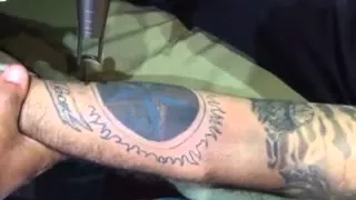 Video de remoción de tatoos con Láser Spectra XT -El poder del láser