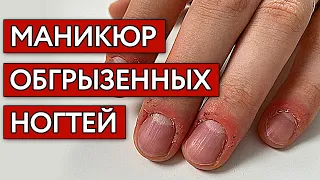 Обгрызыши! Преображение обкусанных ногтей | Как сделать маникюр на обгрызенные ногти?
