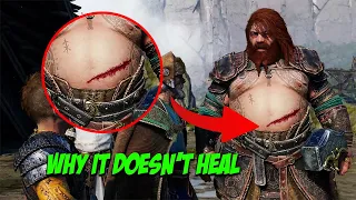 This is Why Thor's wound didn't heal - God of War Ragnarok