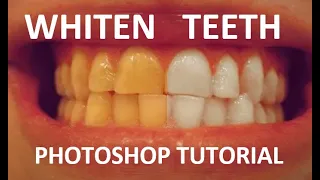 EASILY Whiten Teeth in Photoshop! (2 Minute Tutorial)