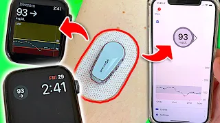 How to View Blood Sugars on Phone and Watch: 4 Tips for Dexcom Users