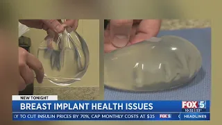 Breast Implant Health Issues