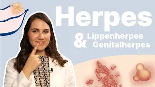Herpes am Mund schnell weg bekommen? Und Intimherpes am Mund - möglich? 👄│Dr. med. Alice Martin
