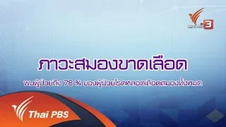 รู้เท่ารู้ทัน : โรคหลอดเลือดสมอง (30 ส.ค. 61)