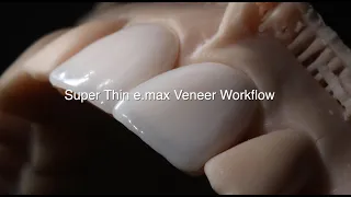 Super Thin e.max Veneer Workflow