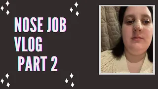 Nose Job Vlog Part 2 Days 4-7 I got my cast off