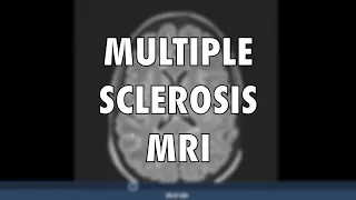 Multiple Sclerosis Vlog: MS MRI
