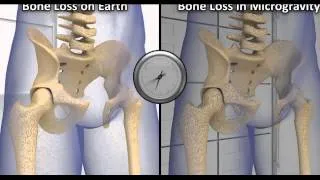 Space Bone Density Decreases in Space   What to Do!   Video