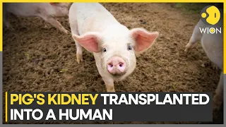 Major breakthrough as pig-to-human kidney transplant succeeds for a month | WION