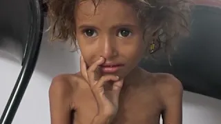 یمن کے کئی علاقوں میں قحط، لوگ پتے کھانے لگے