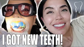 MY TEETH JOURNEY |  BEFORE VENEERS AND AFTER