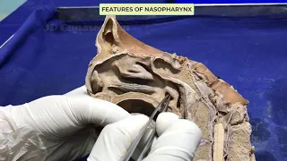 Pharynx I : Internal features