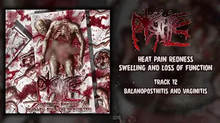 Porifice - Heat Pain Redness Swelling And Loss Of Function FULL ALBUM (2019 - Goregrind)