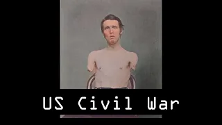 35 Colorized Pictures from the American Civil War