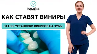 Установка Виниров. Как Ставят Виниры на Зубы - Одесса, стоматология Улыбка