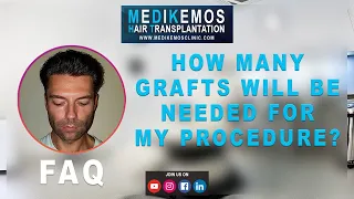 #1 Medikemos Q A How many grafts will be needed for my procedure?