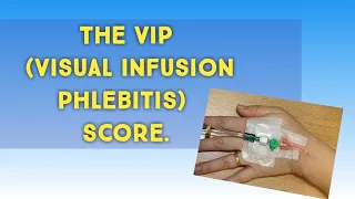 VIP score ( visual infusion phlebitis score),  size of cannula and color code