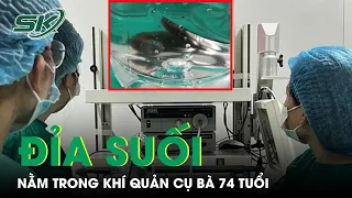 Khó tin: Đỉa Suối Nằm Trong Khí Quản Cụ Bà 74 Tuổi I SKĐS