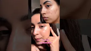 Do this before doing any more skincare !!! Dr. Riya