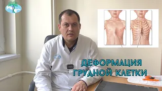 ДЕФОРМАЦИЯ ГРУДНОЙ КЛЕТКИ