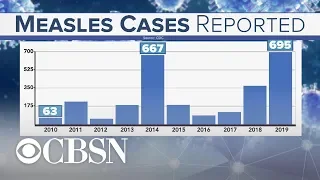 What are the facts on the measles outbreak?