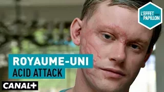 Royaume-Uni : Acid attack - L'Effet Papillon