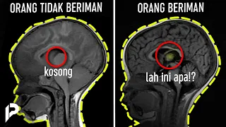 Scientifics’ Shock  when look at this! The Stunning brain difference/ between Believers