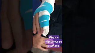 Férula en fractura de dedo meñique