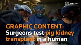 WARNING - GRAPHIC CONTENT:  Surgeons test transplanting pig kidney into human