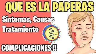 Que es la PAPERAS  O PAROTIDITIS  | TEMA COMPLETO