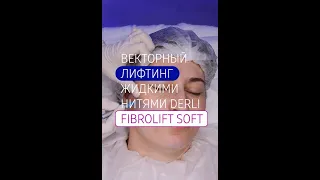 Векторный лифтинг жидкими бионитями Derli FIBROLIFT SOFT