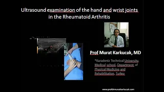 Ultrasound examination of the hand and wrist joints in the Rheumatoid Arthritis