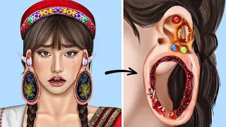 ASMR Remove Worm & Maggot Ear Infected | Severely Injured Animation