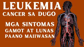 Leukemia - Mga Sintomas, Sanhi, Lunas at GAMOT | CANCER sa DUGO