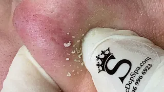 Satisfying Relaxing with Sac Dep Spa Video (#122)