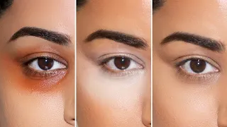 See How Different Concealer Shades can Completely Change your Look!!